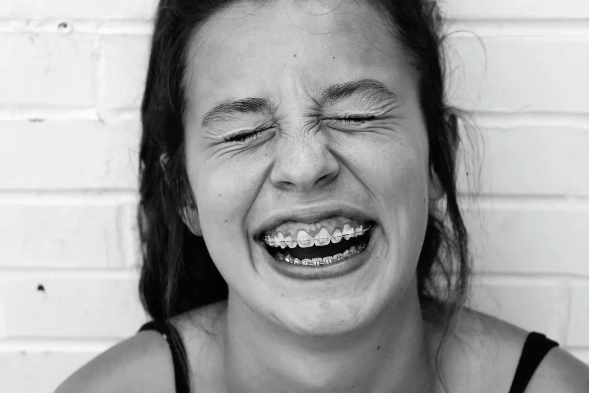 a black and white phot of a smiling girl with braces