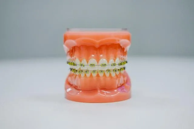 a dental model with complete braces in neon green