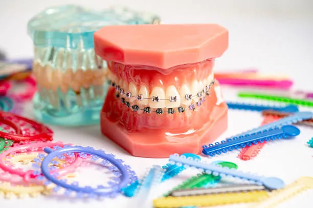 a dental model with full braces and rubber bands around it