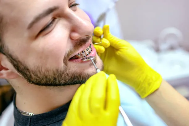 image of a person with braces during a dental examination